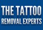 The Tattoo Removal Experts 377743 Image 2
